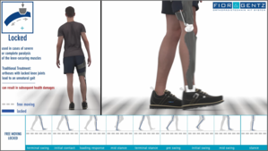 Depiction of the function of a KAFO orthosis with a locked knee joint and clear upper body movement through hip lifting and circumduction in the middle swing phase