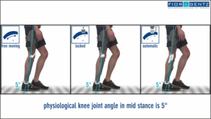 Comparison of the function of a KAFO orthosis in the side view, each with a freely movable, locked and automatic knee joint with stance phases controlled sco in the middle stance phase