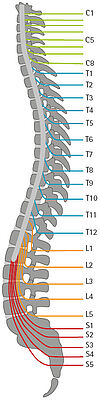 spine to show the height of the lesion in the spinal cord and the nerve tracts after spinal cord injury paraplegia spinal cord lesion and determination of the limitations caused by paralysis and the possibility of fitting medical device orthotics orthosis