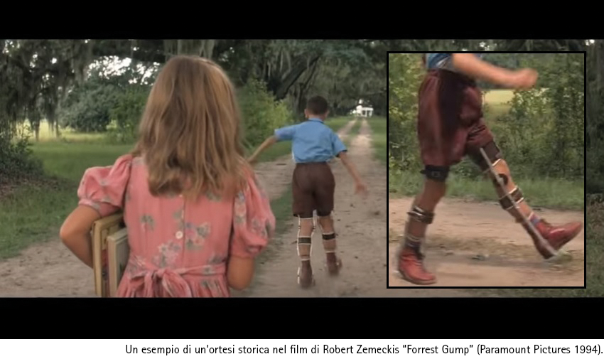 Forrest Gump con ortesi KAFO storica ritrae un vecchio modello di tutore per gamba che invece di aiutare rappresenta un ostacolo nella deambulazione
